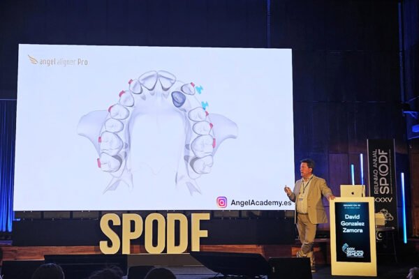 Ortodoncia Madrid SPODF