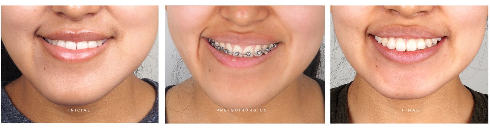 CLASE-III_caso-sonrisas
