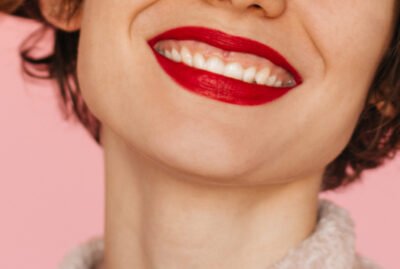 sonrisa-gingival