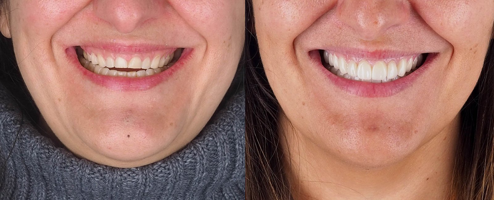 sonrisa_3.jpg