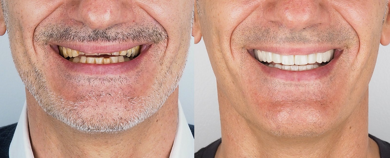 sonrisa_4.jpg