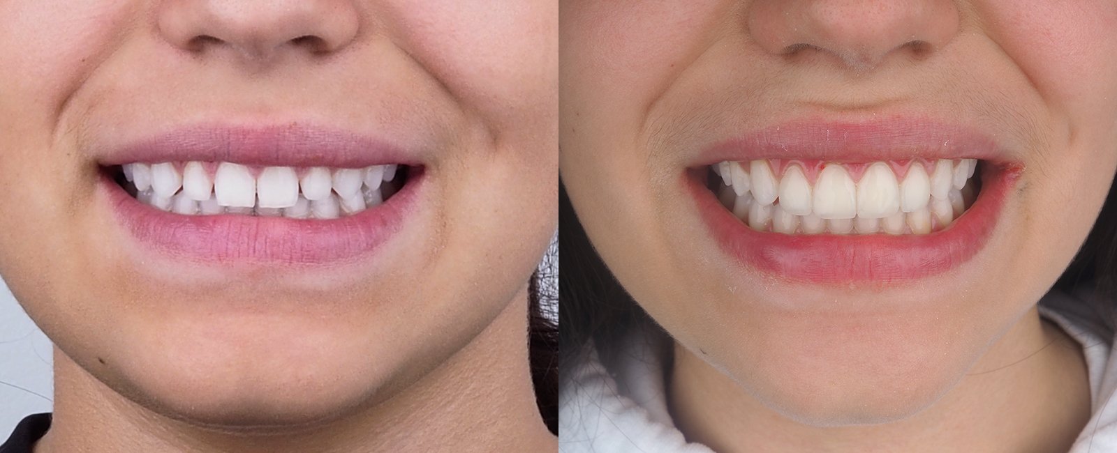 sonrisa_6.jpg