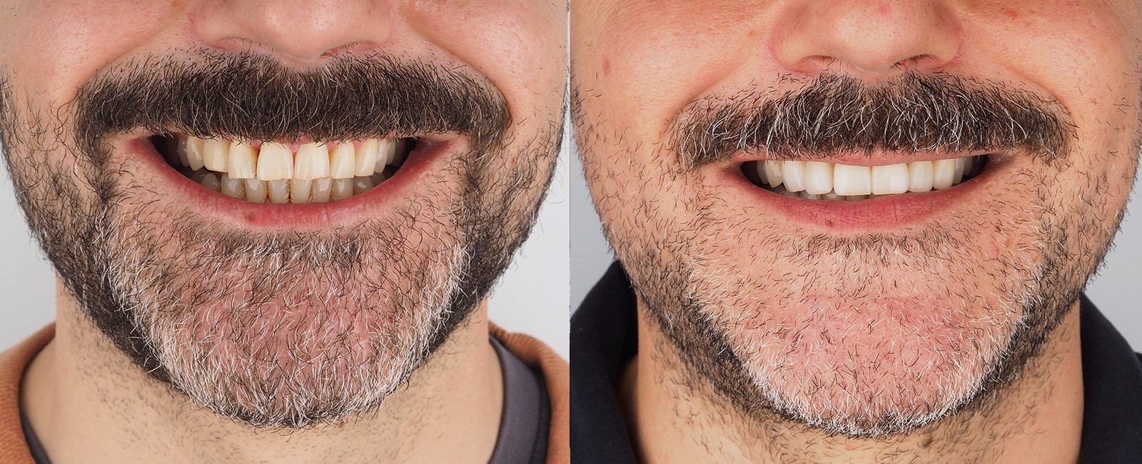 sonrisa_7.jpg