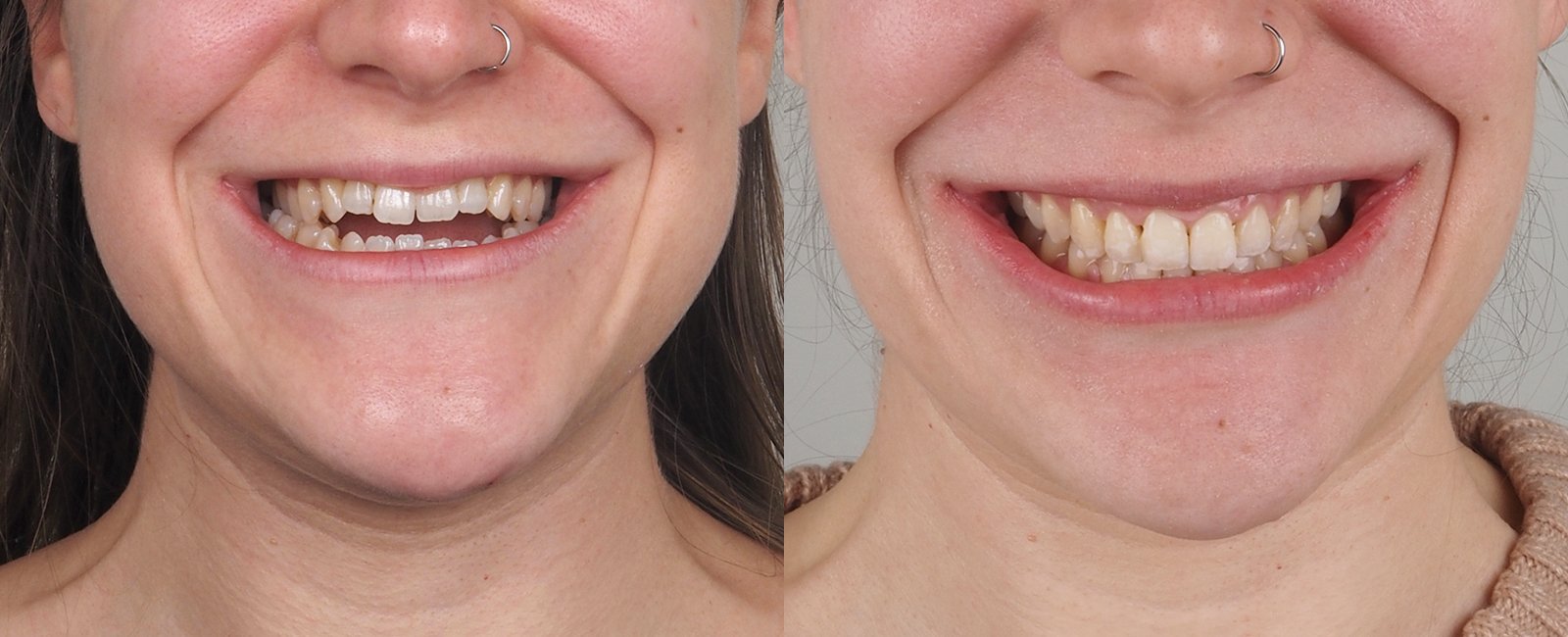 sonrisa_orto.jpg