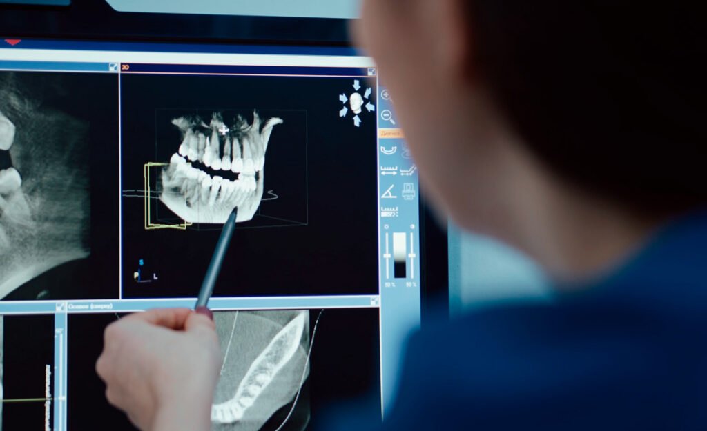cbct